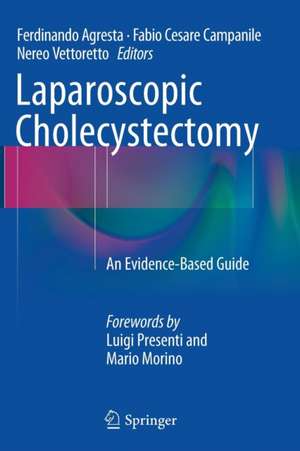 Laparoscopic Cholecystectomy: An Evidence-Based Guide de Ferdinando Agresta