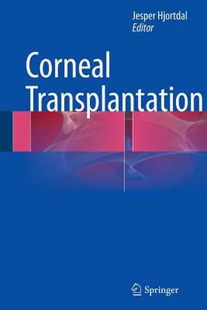 Corneal Transplantation de Jesper Hjortdal