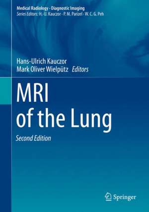 MRI of the Lung de Hans-Ulrich Kauczor