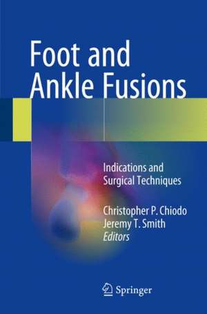 Foot and Ankle Fusions: Indications and Surgical Techniques de Christopher P. Chiodo