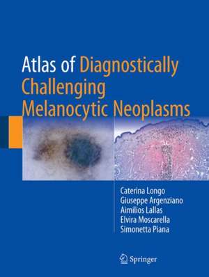 Atlas of Diagnostically Challenging Melanocytic Neoplasms de Caterina Longo