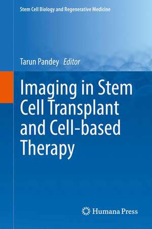 Imaging in Stem Cell Transplant and Cell-based Therapy de Tarun Pandey