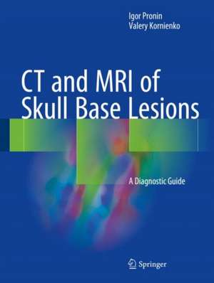 CT and MRI of Skull Base Lesions: A Diagnostic Guide de Igor Pronin