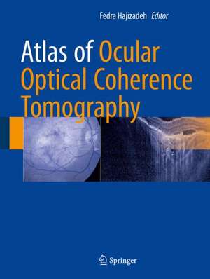 Atlas of Ocular Optical Coherence Tomography de Fedra Hajizadeh