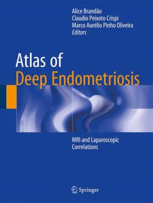 Atlas of Deep Endometriosis: MRI and Laparoscopic Correlations de Alice Brandão