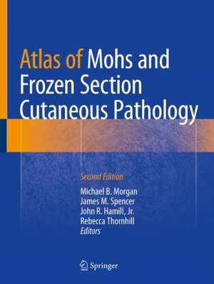 Atlas of Mohs and Frozen Section Cutaneous Pathology de Michael B. Morgan