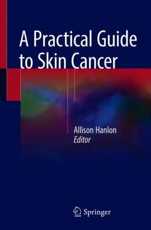 A Practical Guide to Skin Cancer de Allison Hanlon