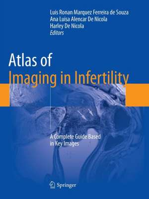 Atlas of Imaging in Infertility: A Complete Guide Based in Key Images de Luis Ronan Marquez Ferreira de Souza