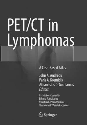 PET/CT in Lymphomas: A Case-Based Atlas de John A. Andreou