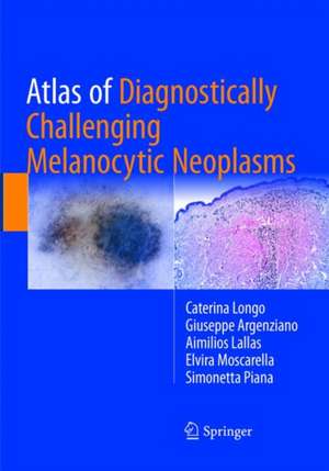 Atlas of Diagnostically Challenging Melanocytic Neoplasms de Caterina Longo