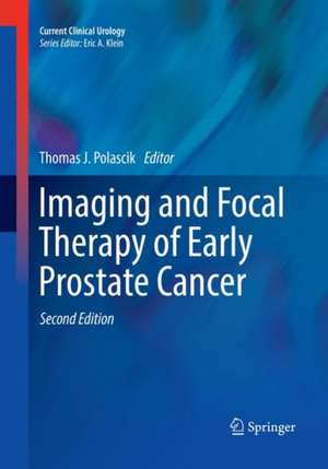 Imaging and Focal Therapy of Early Prostate Cancer de Thomas J. Polascik