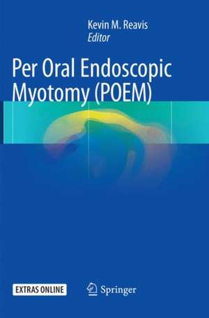 Per Oral Endoscopic Myotomy (POEM) de Kevin M. Reavis