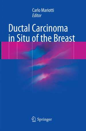 Ductal Carcinoma in Situ of the Breast de Carlo Mariotti