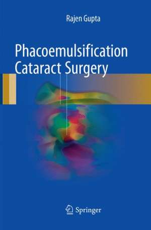 Phacoemulsification Cataract Surgery de Rajen Gupta