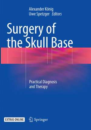 Surgery of the Skull Base: Practical Diagnosis and Therapy de Alexander König