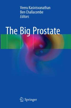 The Big Prostate de Veeru Kasivisvanathan