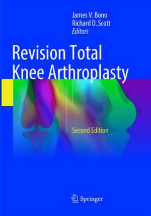 Revision Total Knee Arthroplasty de James V. Bono