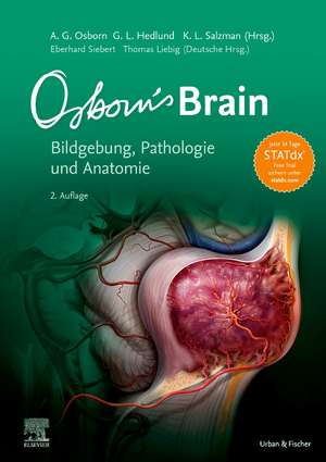 Osborn's Brain de Anne G. Osborn