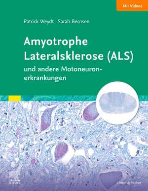 Amyotrophe Lateralsklerose (ALS) und andere Motoneuronerkrankungen de Patrick Weydt