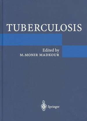 Tuberculosis de M. Monir Madkour