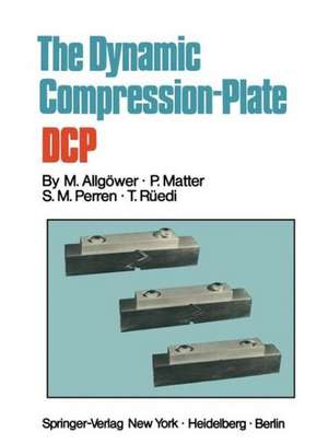 The Dynamic Compression Plate DCP de Martin Allgöwer