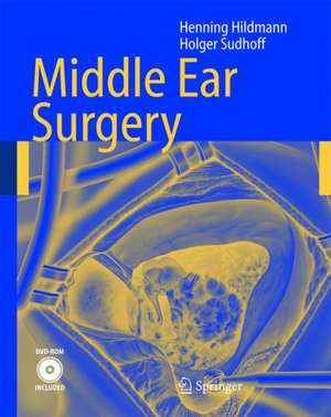 Middle Ear Surgery de Henning Hildmann