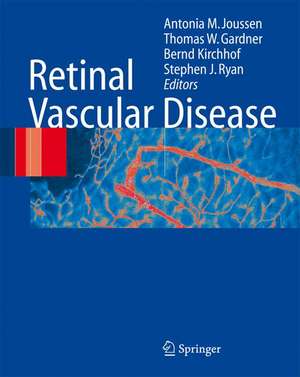 Retinal Vascular Disease de A.M. Joussen