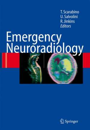 Emergency Neuroradiology de Tommaso Scarabino