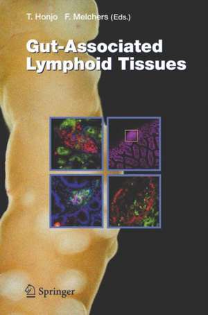 Gut-Associated Lymphoid Tissues de Tasuku Honjo