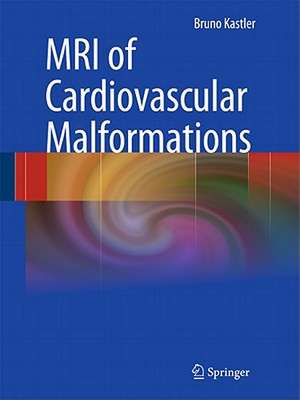 MRI of Cardiovascular Malformations de Bruno Kastler