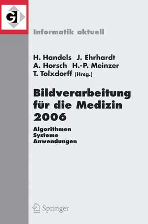 Bildverarbeitung für die Medizin 2006: Algorithmen - Systeme - Anwendungen Proceedings des Workshops vom 19. - 21. März 2006 in Hamburg de Heinz Handels