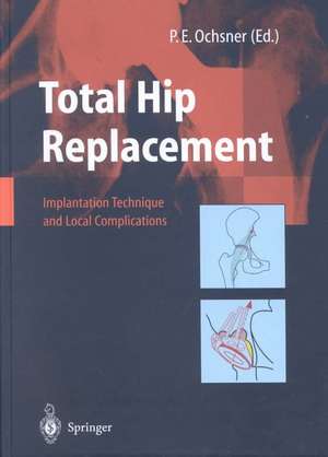 Total Hip Replacement: Implantation Technique and Local Complications de R. Hinchliffe