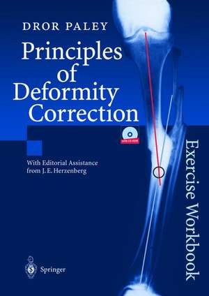 Principles of Deformity Correction: Exercise Workbook de J.E. Herzenberg