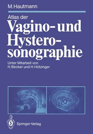 Atlas der Vagino- und Hysterosonographie de Hermann Becker