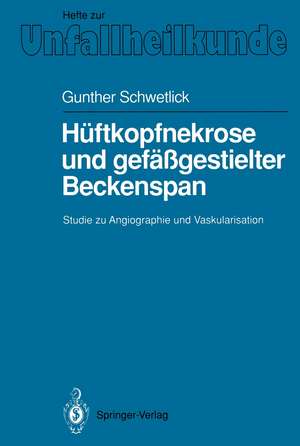 Hüftkopfnekrose und gefäßgestielter Beckenspan: Studie zu Angiographie und Vaskularisation de Gunther Schwetlick