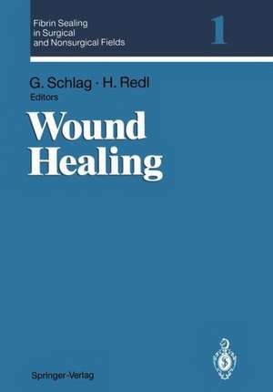 Fibrin Sealing in Surgical and Nonsurgical Fields: Volume 1: Wound Healing de Günther Schlag