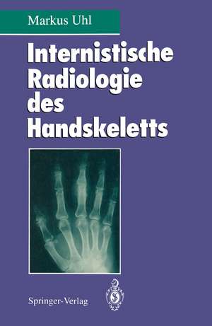 Internistische Radiologie des Handskeletts de Markus Uhl