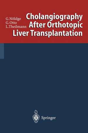 Cholangiography After Orthotopic Liver Transplantation de Gerd Nöldge