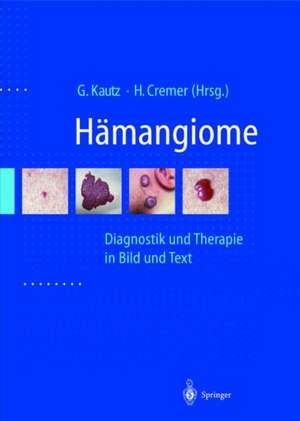 Hamangiome