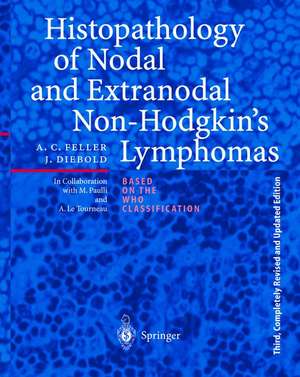 Histopathology of Nodal and Extranodal Non-Hodgkin’s Lymphomas de M. Paulli