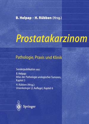 Prostatakarzinom — Pathologie, Praxis und Klinik: Pathologie, Praxis und Klinik de Burkhard Helpap