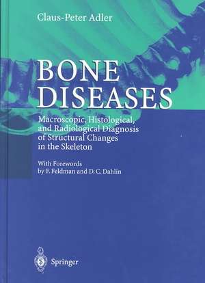 Bone Diseases: Macroscopic, Histological, and Radiological Diagnosis of Structural Changes in the Skeleton de Claus-Peter Adler