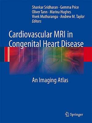 Cardiovascular MRI in Congenital Heart Disease: An Imaging Atlas de Shankar Sridharan