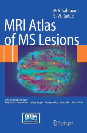 MRI Atlas of MS Lesions de M.A. Sahraian