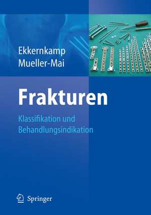 Frakturen: Klassifikation und Behandlungsoptionen de Christian Müller-Mai