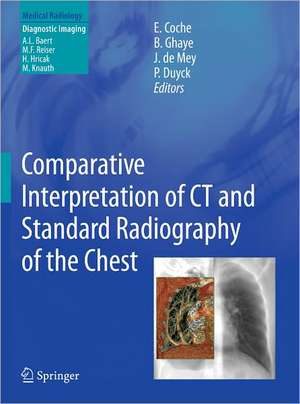 Comparative Interpretation of CT and Standard Radiography of the Chest de Emmanuel E. Coche