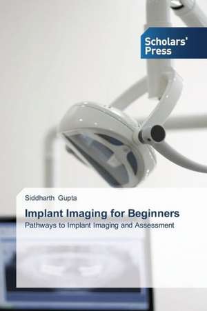 Implant Imaging for Beginners de Siddharth Gupta