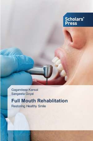 Full Mouth Rehablitation de Gagandeep Kansal