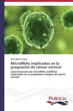 Micrornas Implicados En La Progresion de Cancer Cervical: Factores Que Influyen En Su Ciclo de Vida de JESÚS ADRIÁN LÓPEZ