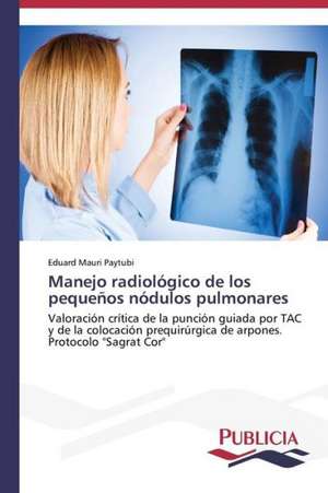 Manejo Radiologico de Los Pequenos Nodulos Pulmonares: Estudio Prospectivo En Espana de Eduard Mauri Paytubi